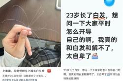 白头发别急着拔！重新变黑发的方法找到了