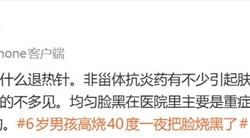 男孩发烧十几个小时：退烧后脸变黑