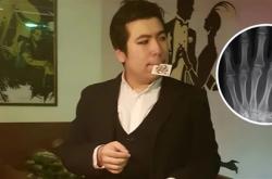 美国魔术师手掌植入芯片 但他忘记了密码