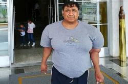 男子潜水氧气管被切断 全身肿胀如大肌霸！11年治疗无果