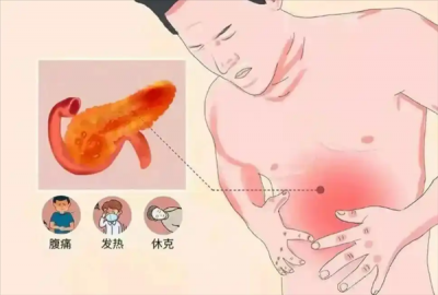 32岁男子体内抽出“牛奶血”：日常以奶茶可乐为主 偏好炸鸡火锅