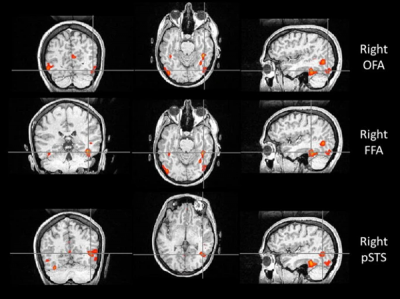 一个人能记住多少个人的脸 这个数字赌你猜不到