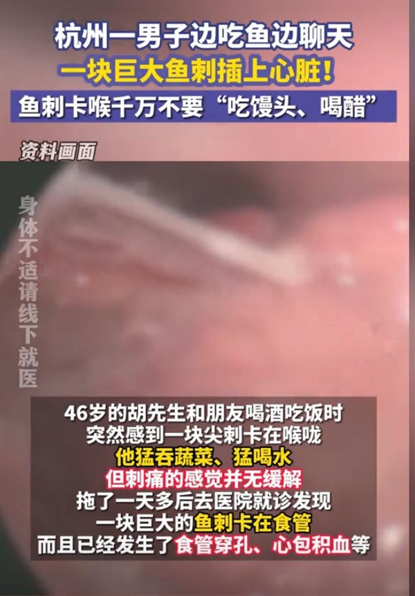 丧命式自救后巨大鱼刺直扎男子心脏 医生:自救方法不可取