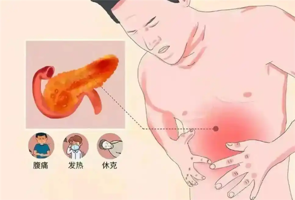 32岁男子体内抽出“牛奶血”:日常以奶茶可乐为主 偏好炸鸡火锅