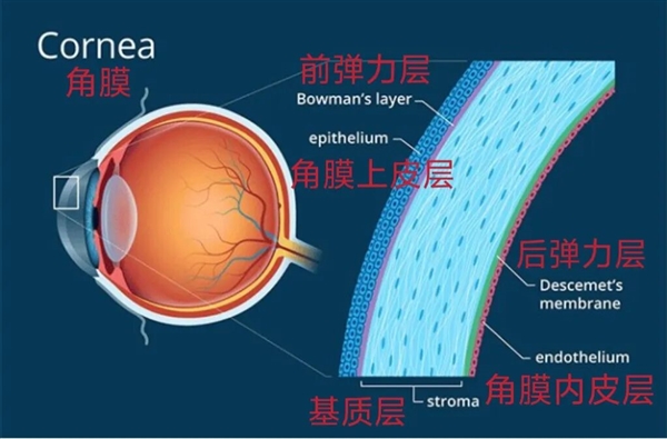 那些做了近视激光手术的人 后来怎么样了?